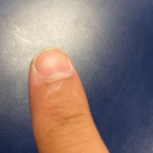 My finger nail